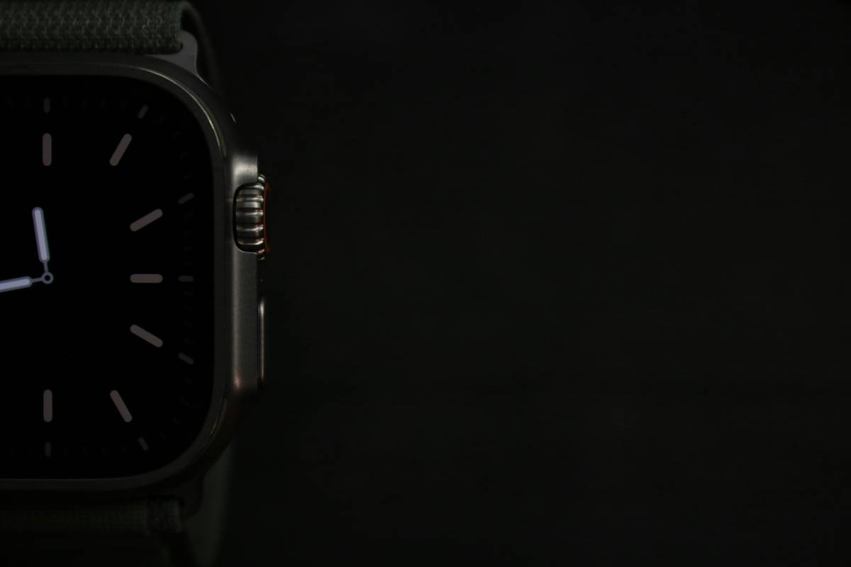 Why Your “Watch Gadget Stem” Might Be the Secret Weapon You Didn’t Know You Needed